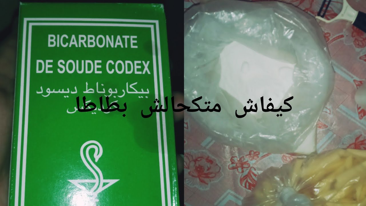 مشروع البطاطس للسناكات 💣💣 كيفاش بطاطا السناكات مكتكحالش بلا تلاجة بلا والو