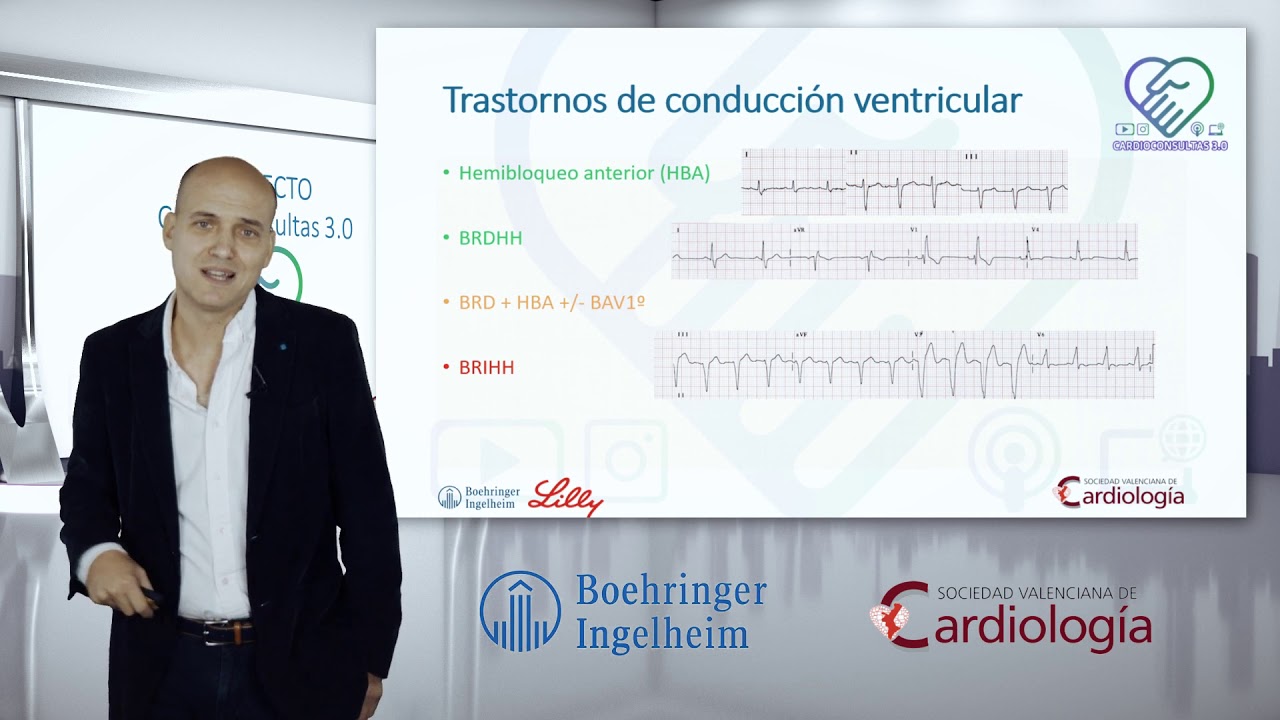 #Cardioconsultas:Alteraciones frecuentes en el ECG