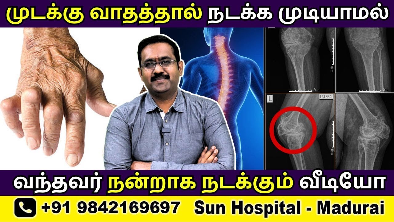 முடக்கு வாதம் | Rheumatoid Arthritis காரணமாக நடக்க முடியலையா?  Exercises in Tamil | Sun Hospital