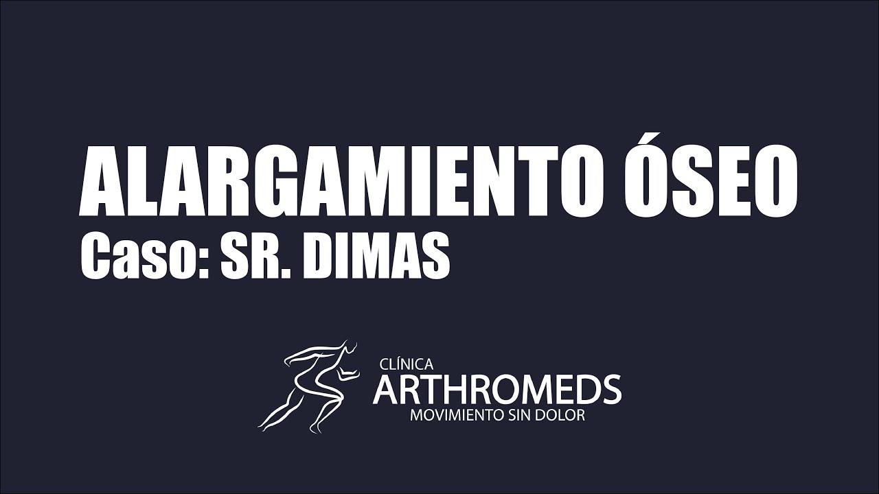 Alargamiento óseo en Lima Perú, caso Sr. DIMAS