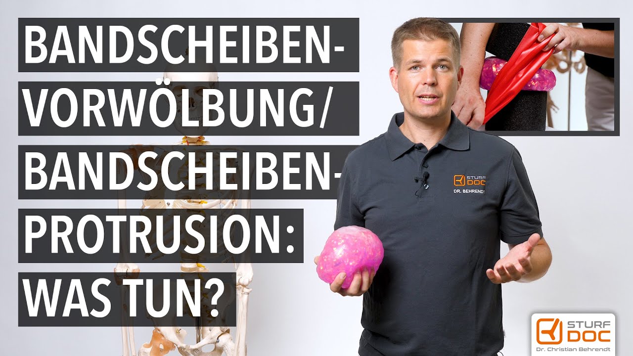 Bandscheibenvorwölbung oder Bandscheibenprotrusion: Was tun?