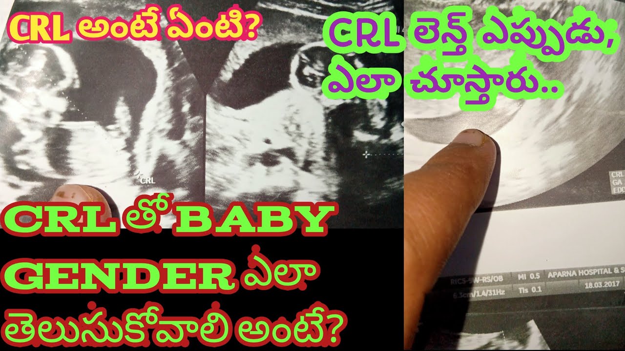 How to Gender Predict CRL Length//CRL Means/CRL Values తోGenderఎలాCalculator చేసుకోవాలి/CRL cm to mm