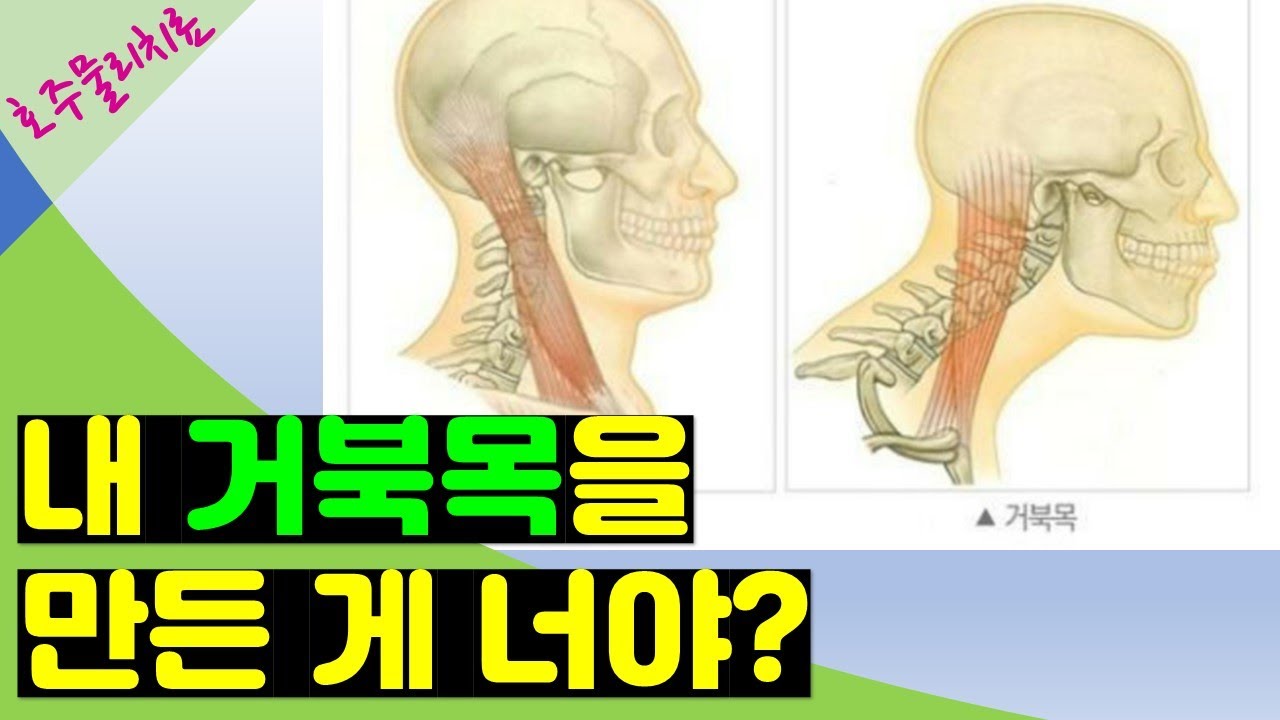 거북목 마사지: 라운드숄더 교정 두통에도 효과만점 - 목마사지 셀프 도수치료 흉쇄유돌근 편