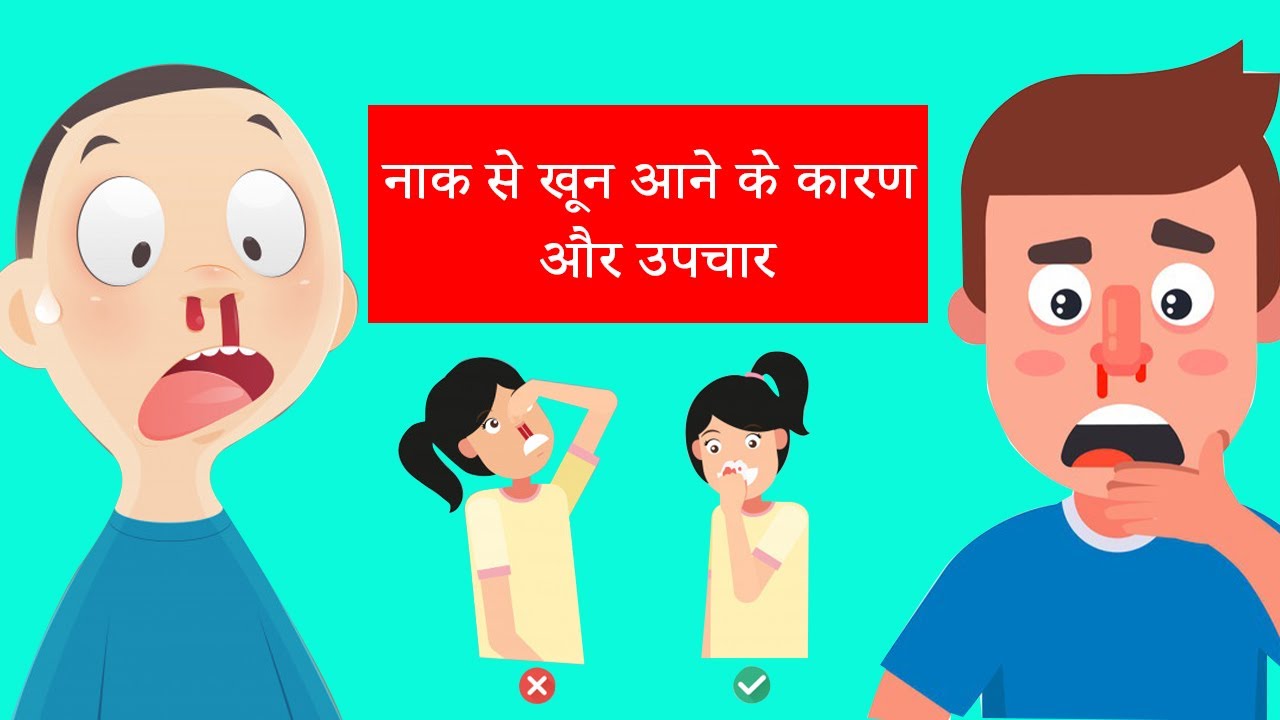 How to Treat a Bleeding Nose | नाक से खून आने के कारण और उपचार | First-Aid in Hindi |