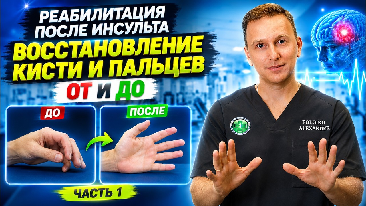 Восстановление движений в кисти и пальцах после инсульта от и до.