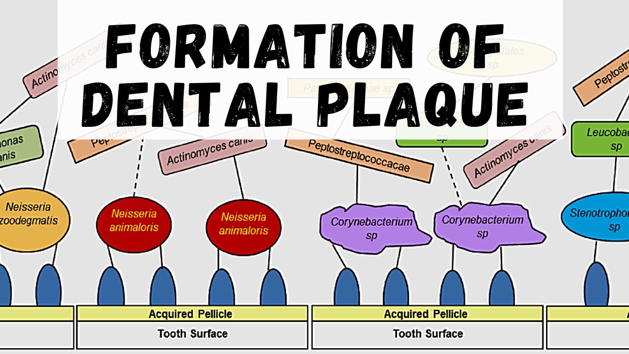 FORMATION OF DENTAL PLAQUE ( Dental Plaque Part 2 )