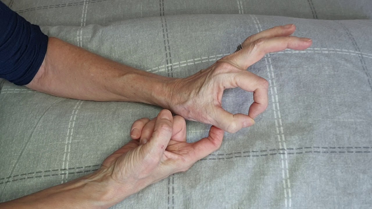 Trapeziectomy. First exercises.