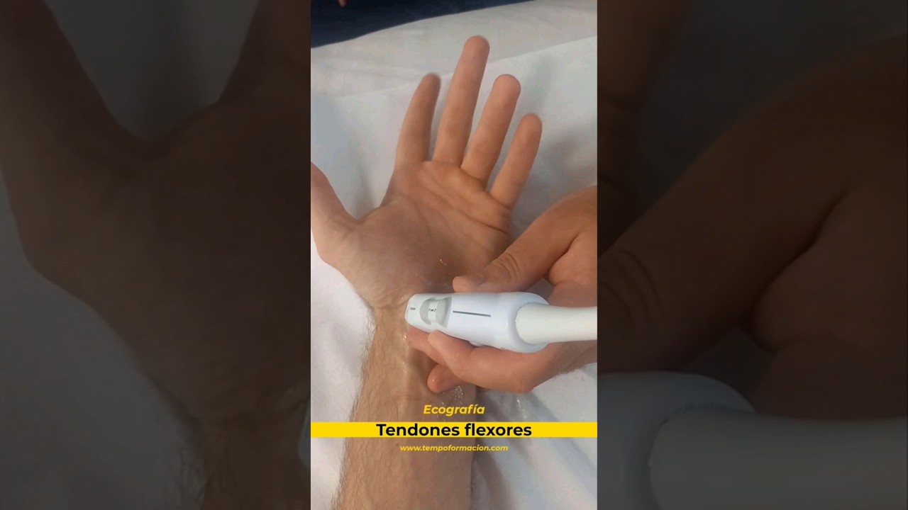 Prueba din&aacute;mica tendones flexores de la mu&ntilde;eca #ecografia #fisioterapia #tempoformacion