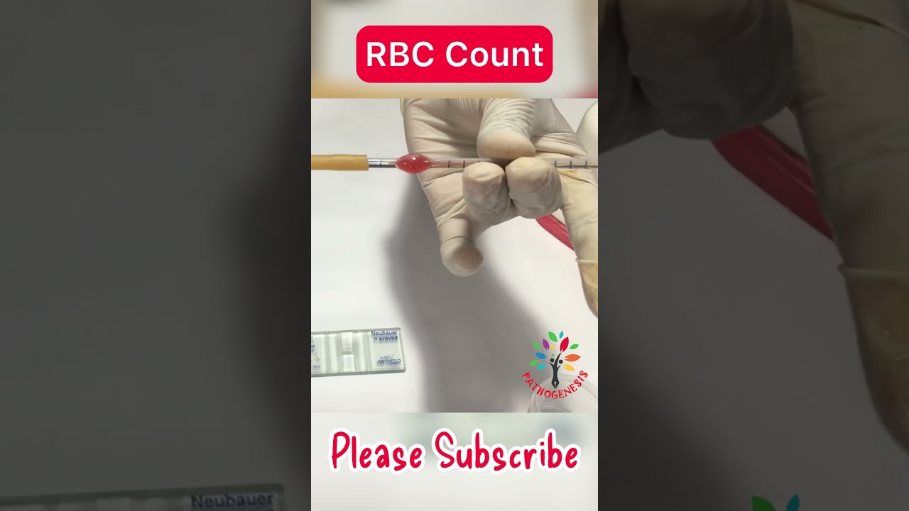 RBC count ll RBC count practical physiology #PATHOGENESIS ll #MLT #Physiology_Practical