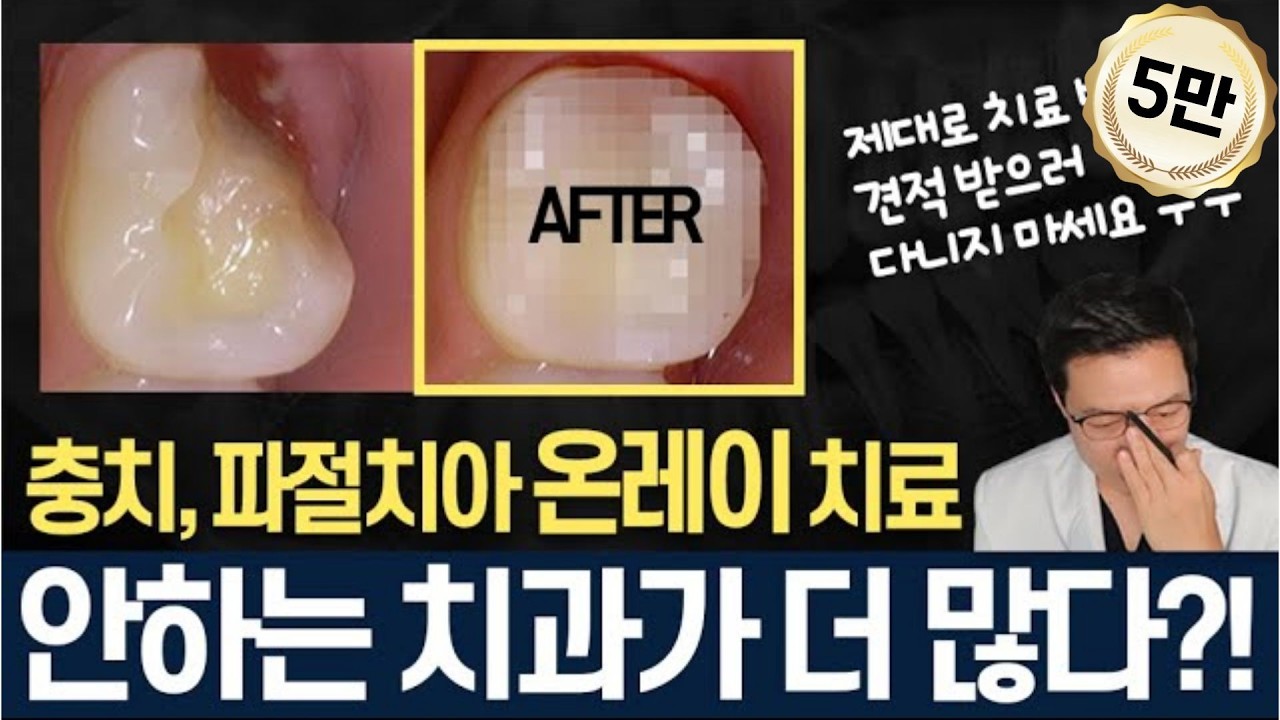 어금니 치아 파절 발견! 인레이?온레이? 크라운?깨진어금니 치료방법  치과치료 제대로 받으려면 제대로 치과견적 받으러 다니지 마세요😢😭