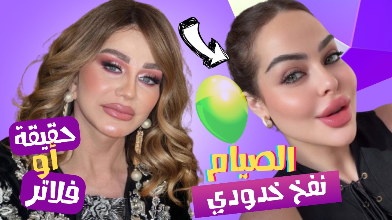 الصقر : ما حقيقة صور ميادة الحناوي بعد شد الوجه , معقول الصيام نفخ خدود زين كرزون ؟