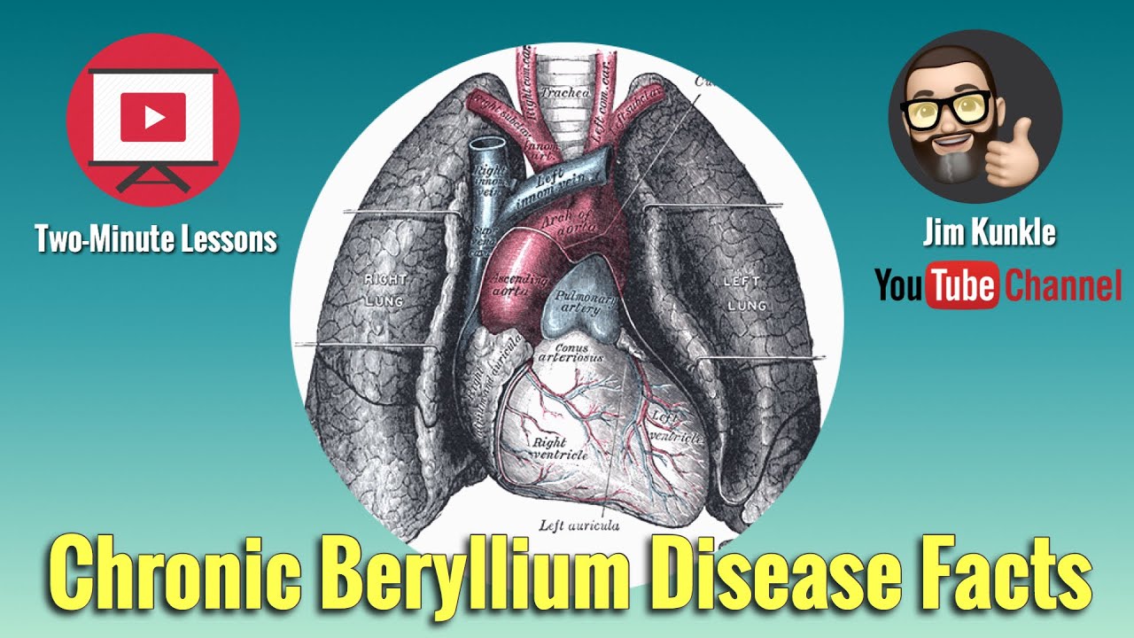 Two Minute Lessons:  Chronic Beryllium Disease (CBD) Facts