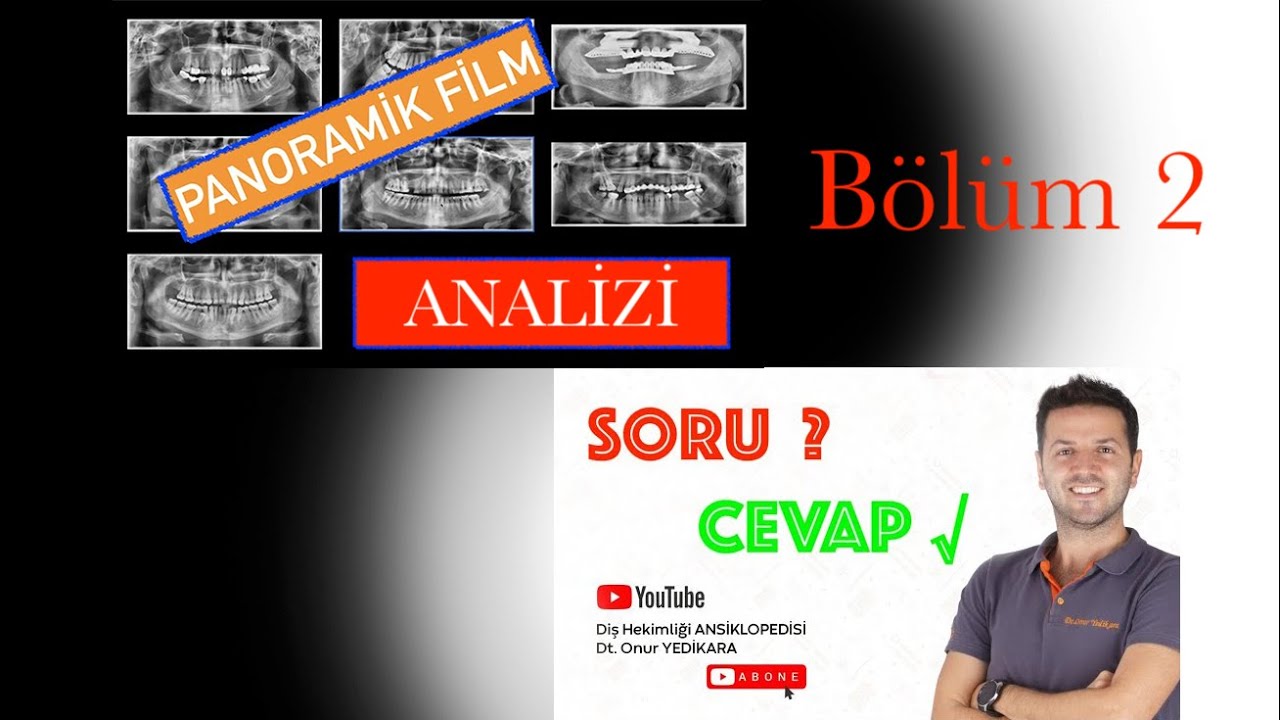 Panoramik Film Analizi - Soru Cevap ( Bölüm 2 )