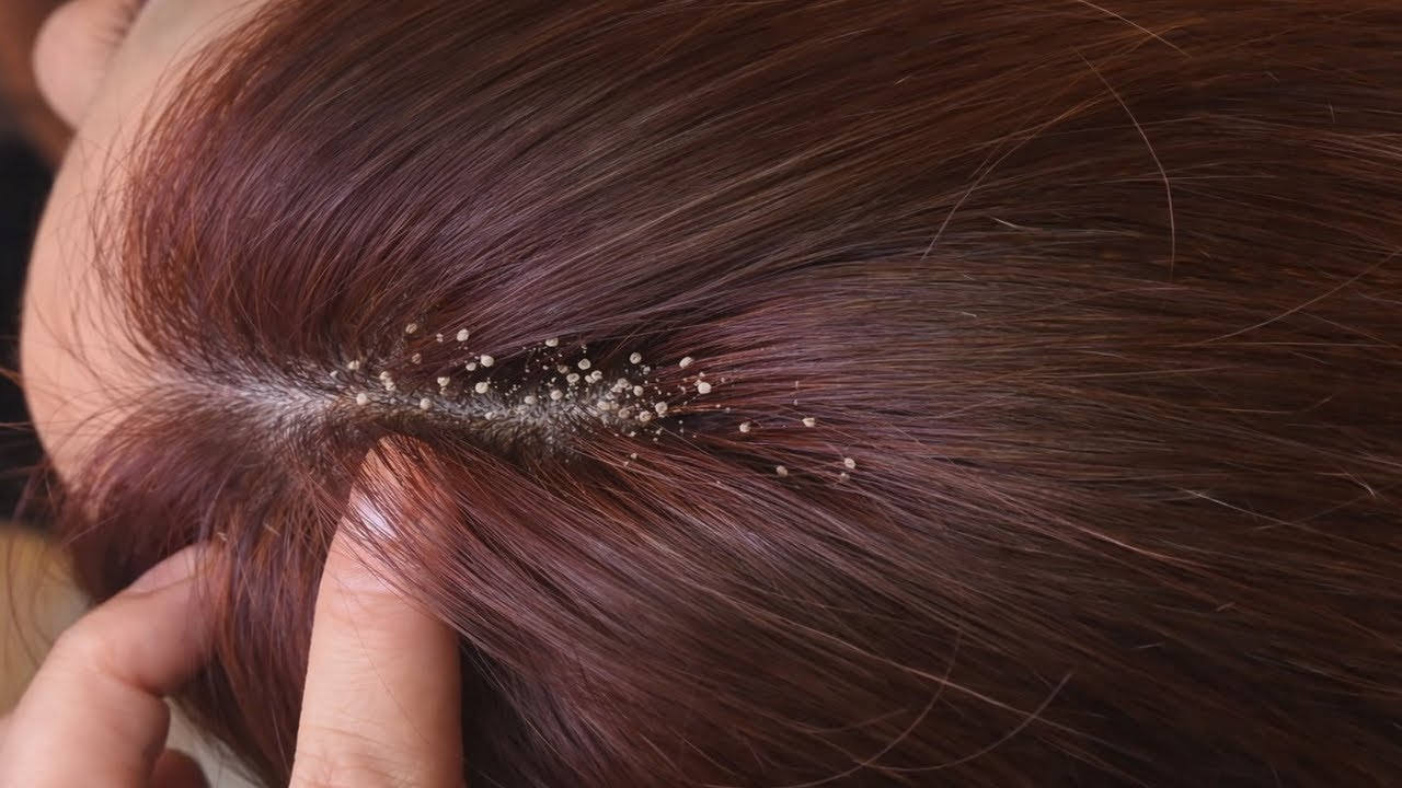 Ultimate ASMR Scalp Care Therapy | Deep Hair Cleaning for Total Stress Relief