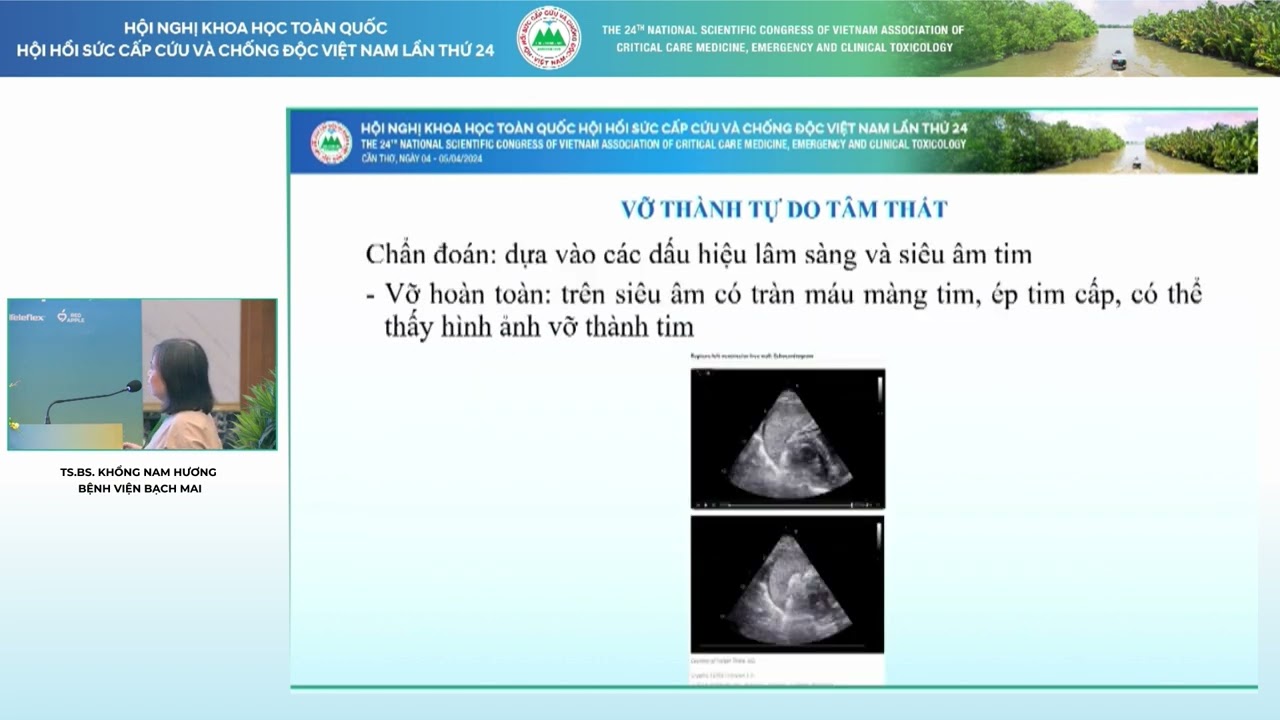 HSCC 2024  - TS. Khổng Nam Hương - Tim mạch