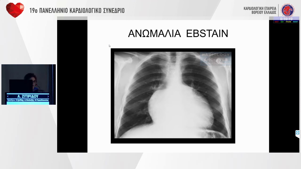 Λ. Ζιτιρίδου  | Ακτινογραφία θώρακος στα καρδιαγγειακά νοσήματα