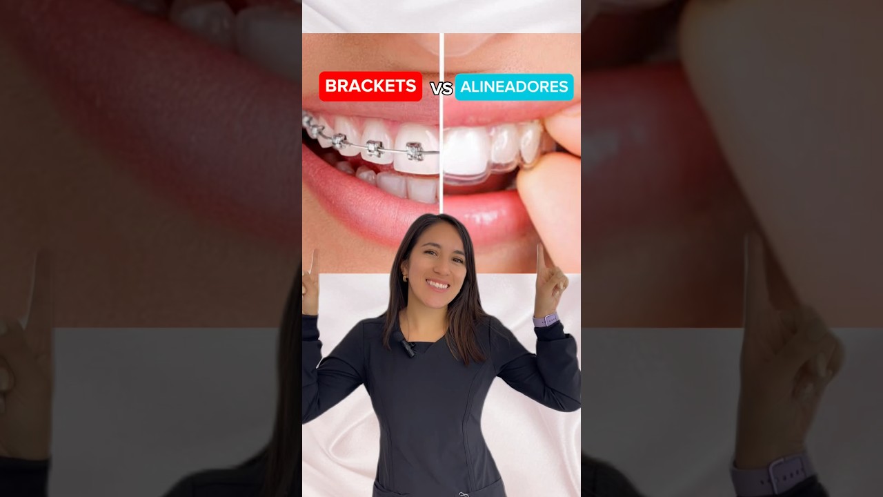 BRACKETS vs. ALINEADORES | &iquest;Cu&aacute;les son sus diferencias?🤔