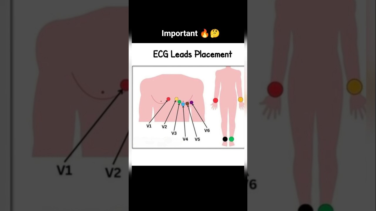 ECG leads placement 📚✅