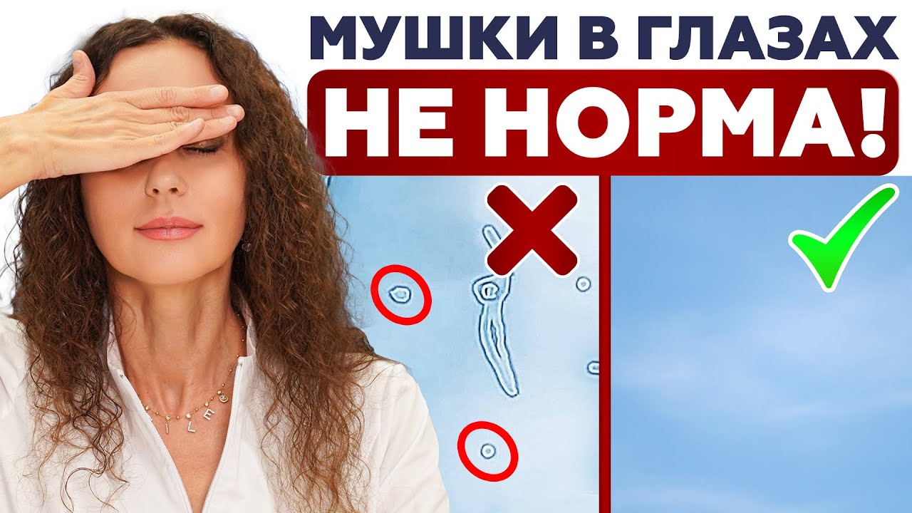 Срочно ПРОВЕРЬТЕ сетчатку! Счет идет НА минуты! Как вовремя заметить отслойку?