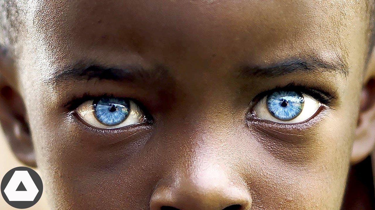 10 Rarest Black Kids Whose Eyes Are One in a Million..