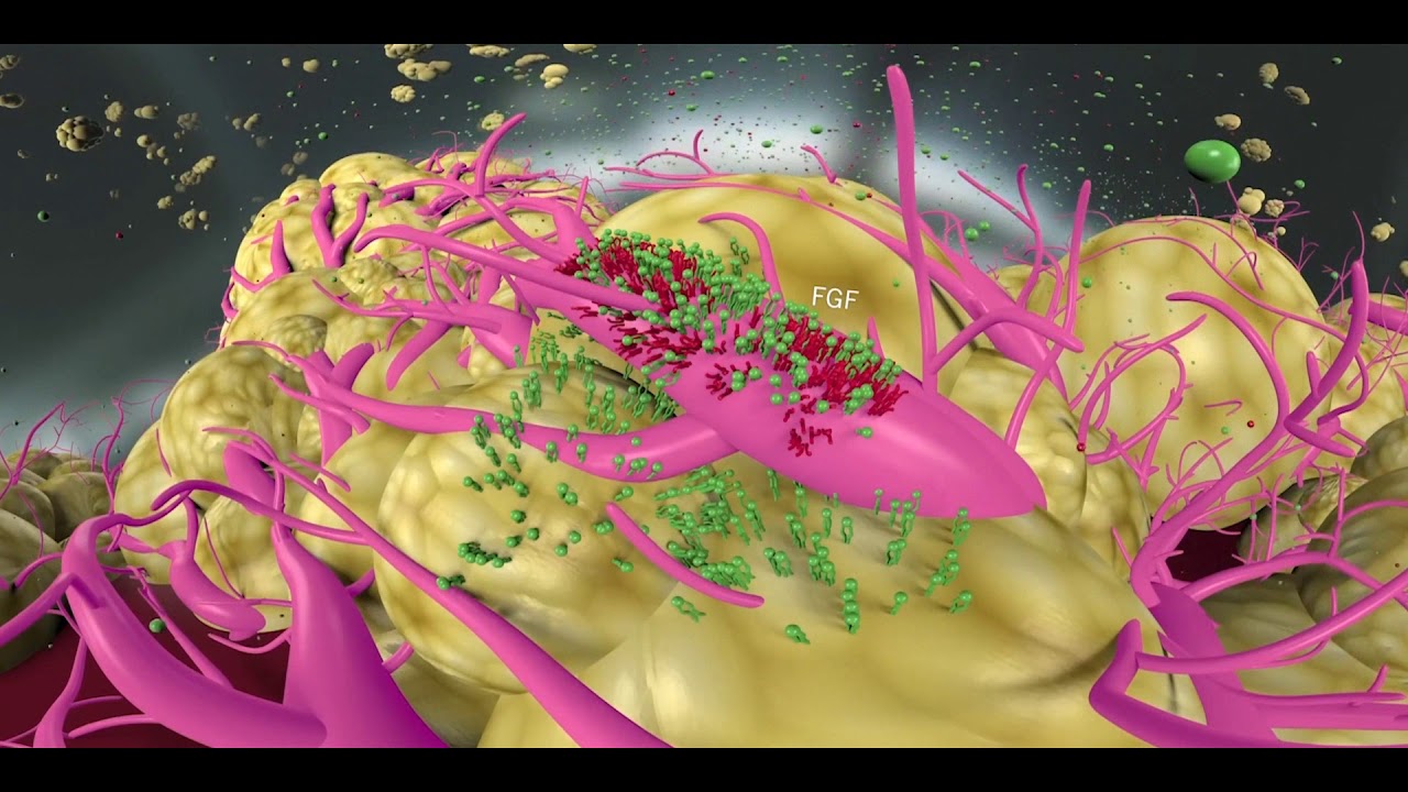 HCC pathophysiology, treatments and mechanisms