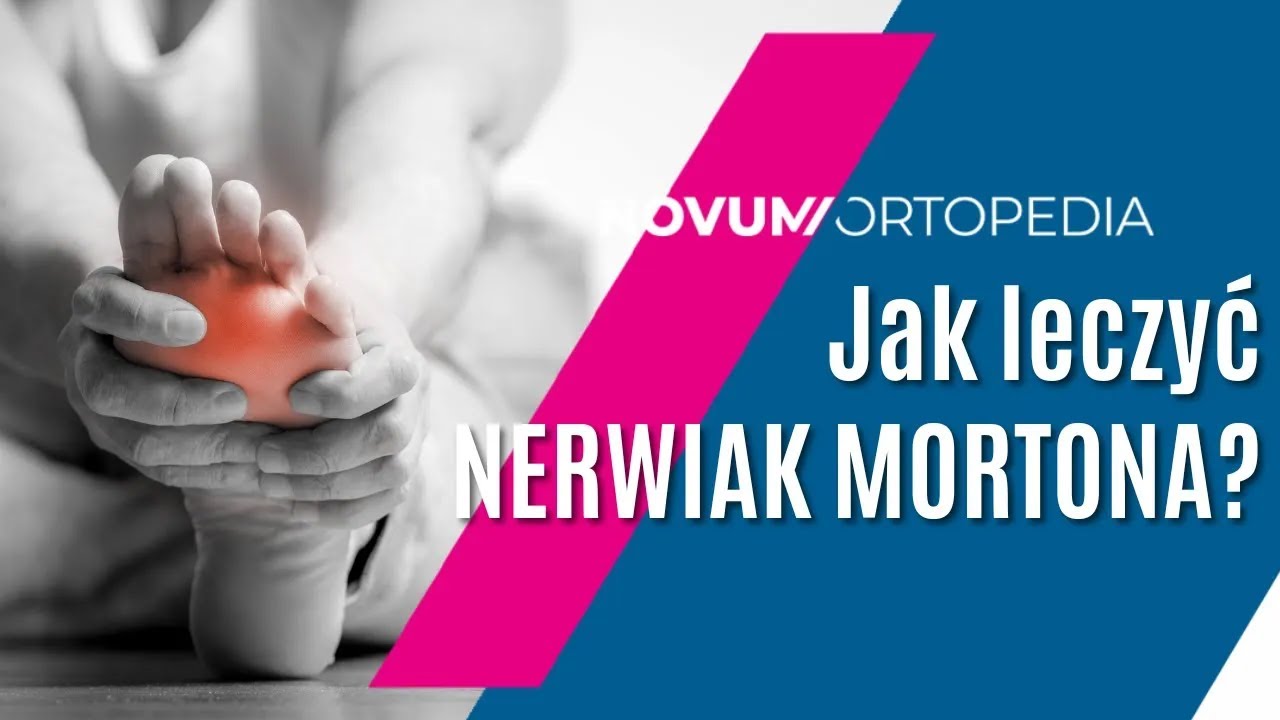 B&oacute;l STOPY? To może być NERWIAK MORTONA | Jak leczyć tę dolegliwość? | Novum Ortopedia