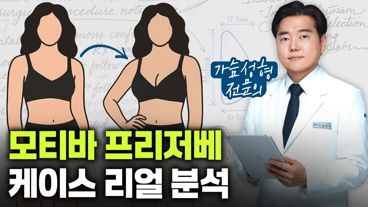 모티바 프리저베 가슴성형 케이스 리얼 분석ㅣ모티바 키닥터 최상문박사