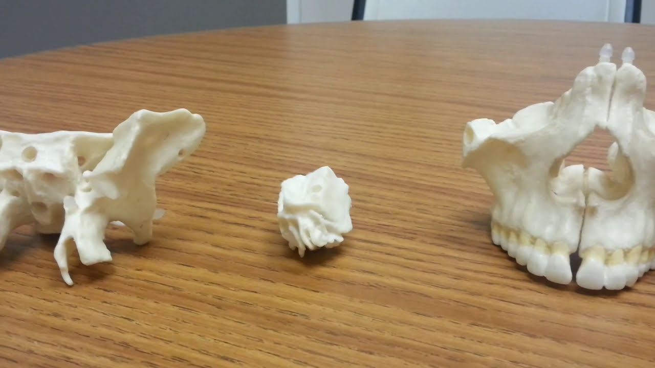Review of Skull Bones: What's In Your Head