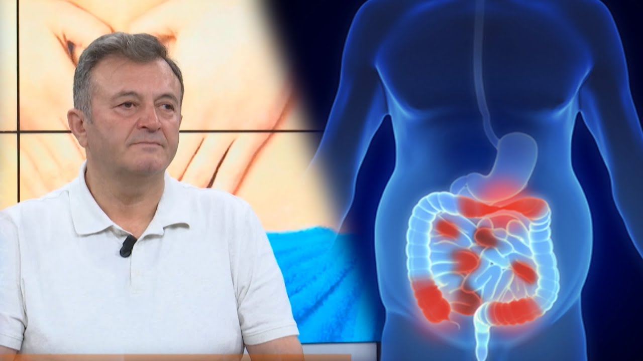 Sëmundja e inflamacionit të zorrëve (Crohn) që prek adoleshentët /Ylli Merja: Ja disa nga shkaktarët