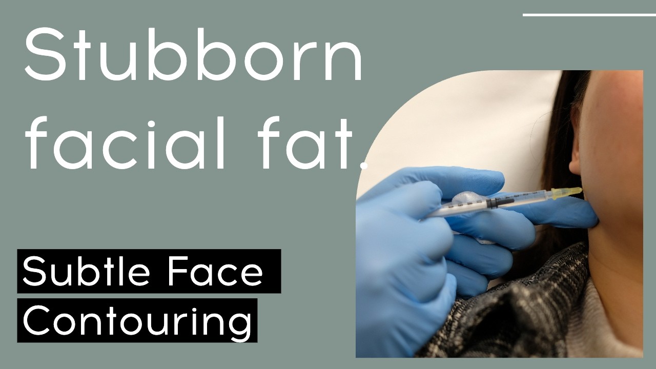 Prostrolane Fat Dissolve London: Jawline & Face Contouring | OSO Clinic