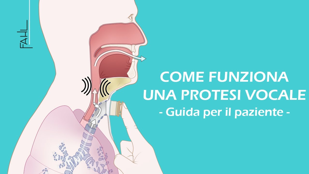 Come funziona una protesi vocale | Animazione | Fahl Medizintechnik-Vertrieb GmbH