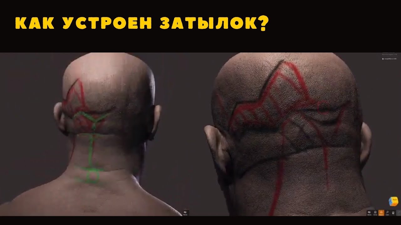 Разбираемся, как устроен затылок - мышцы, складки...