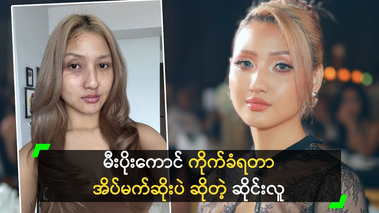 မီးပိုးကောင် ကိုက်ခံရတာ အိပ်မက်ဆိုးပဲ ဆိုတဲ့ ဆိုင်းလူ