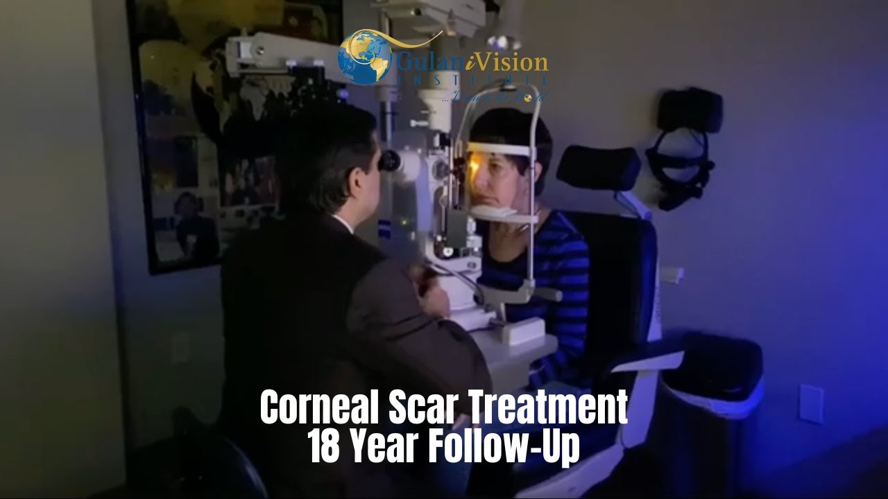 Corneal Scar Treatments @GulaniVision