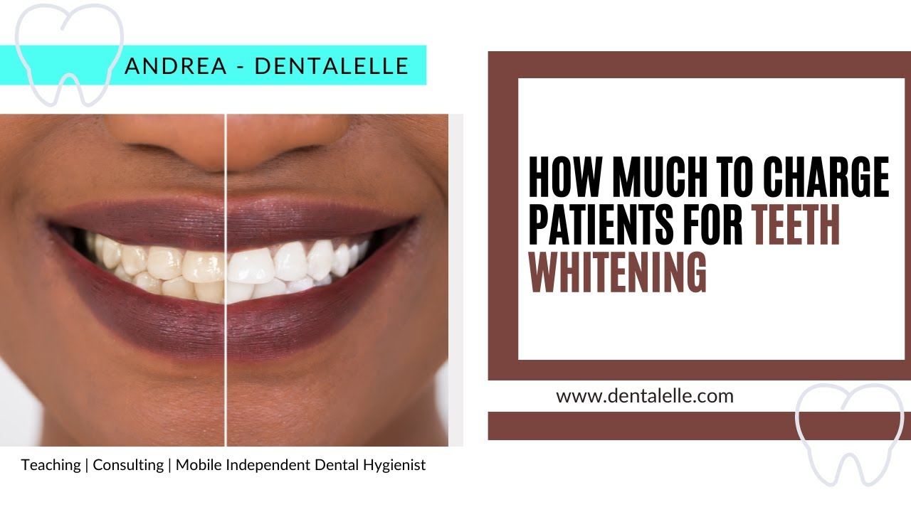 How Much To Charge Your Patients for Teeth Whitening