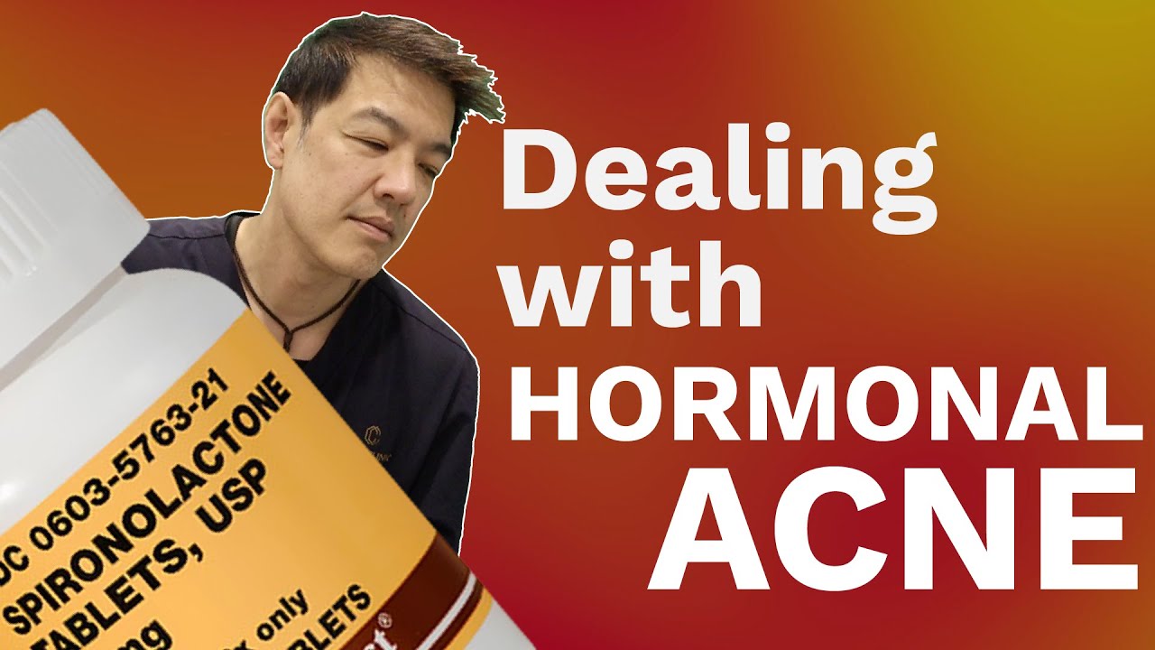 How to manage Hormonal Acne | Dr Davin Lim