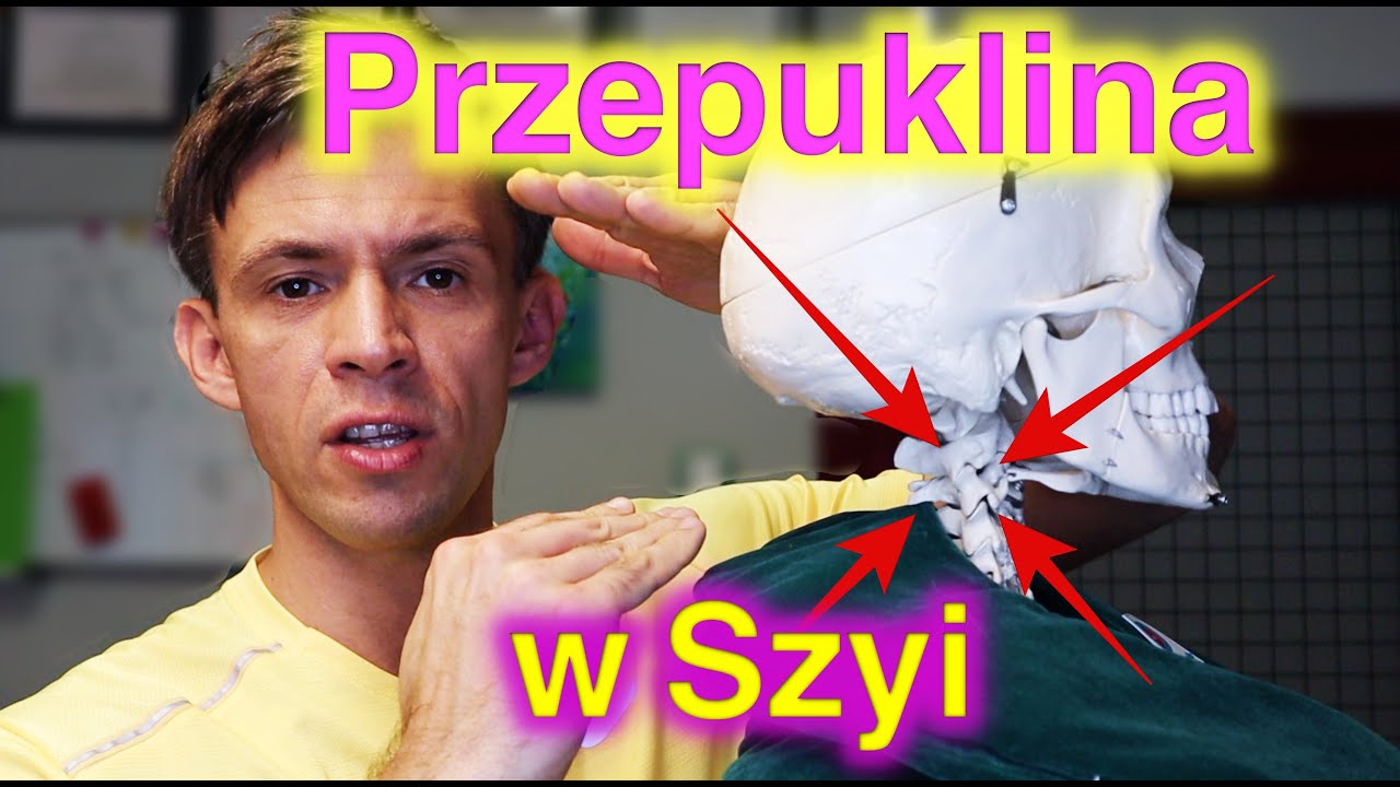 Ból szyi. Dyskopatia, przepuklina w odcinku szyjnym. Jedno ćwiczenie. Trakcja.