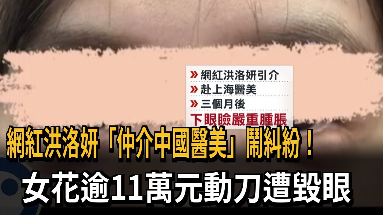 網紅洪洛妍「仲介中國醫美」鬧糾紛！　女花逾11萬元動刀遭毀眼－民視新聞