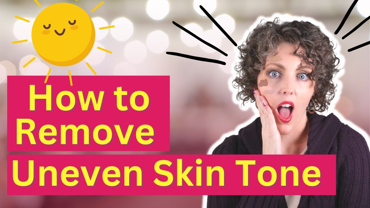 Beginner's Guide To Uneven Skin Tone