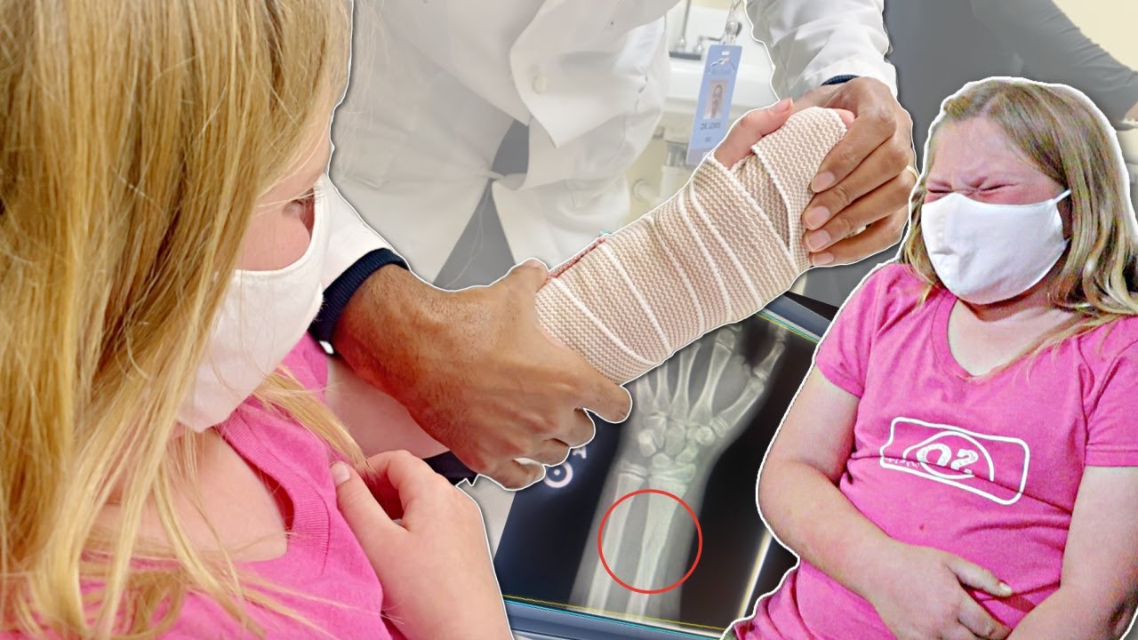 She BROKE Her ARM!