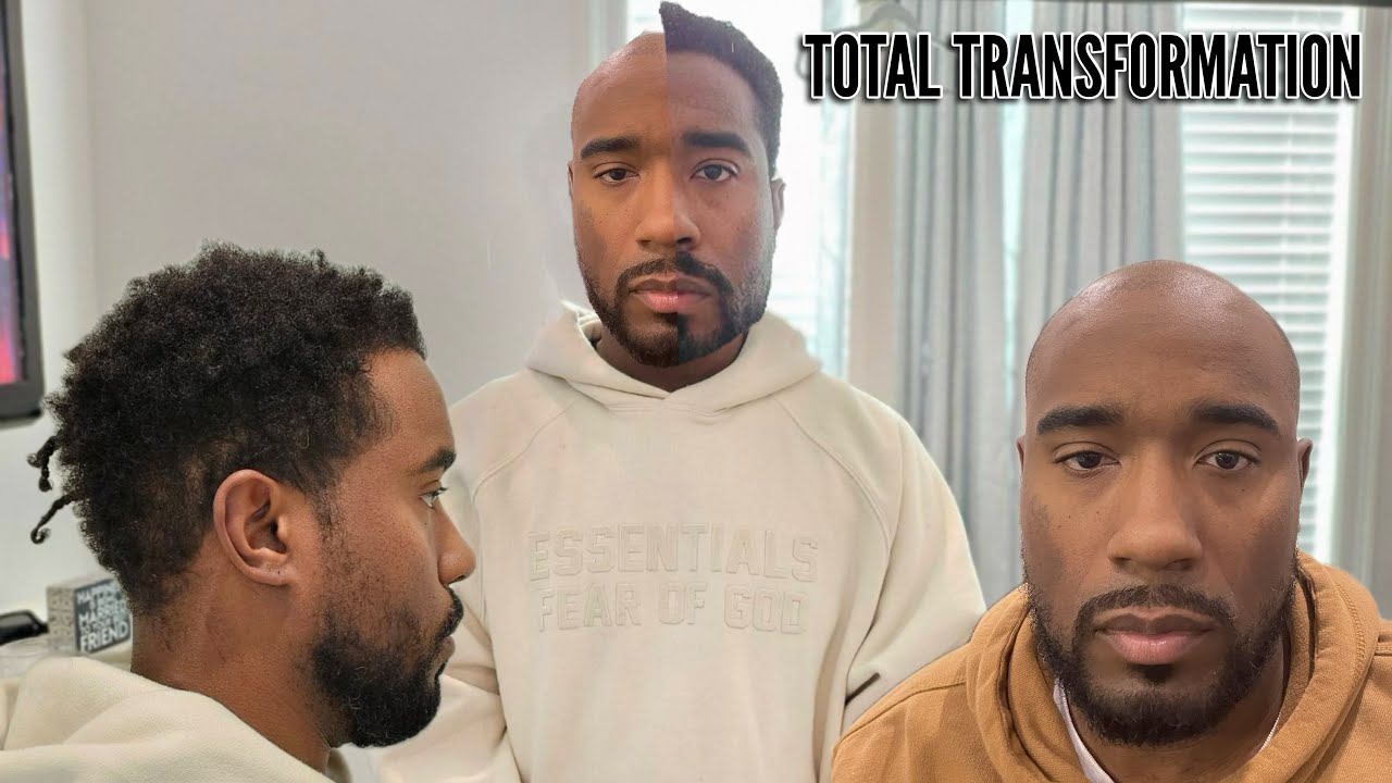 Final REVEAL AFTER MY 2yr FUE HAIR TRANSPLANT JOURNEY