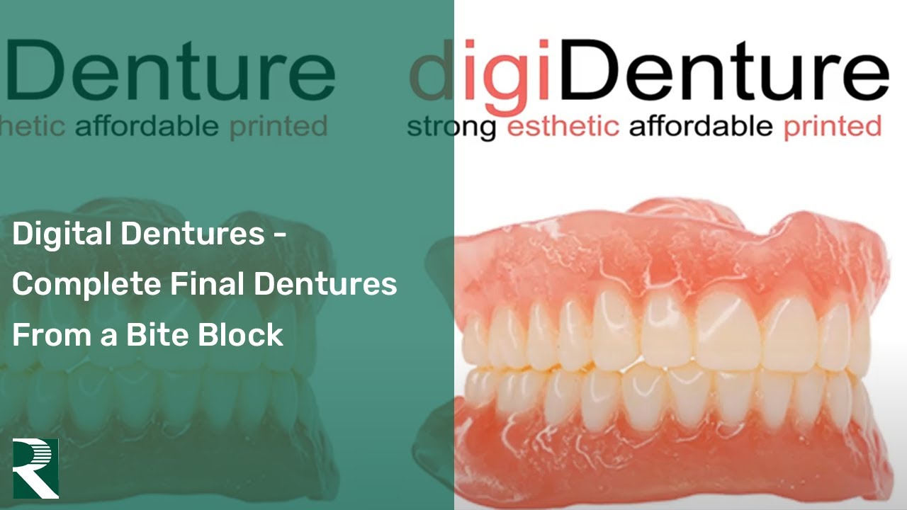 Digital Dentures – Complete Final Denture from a Bite Block in 2 Appointments
