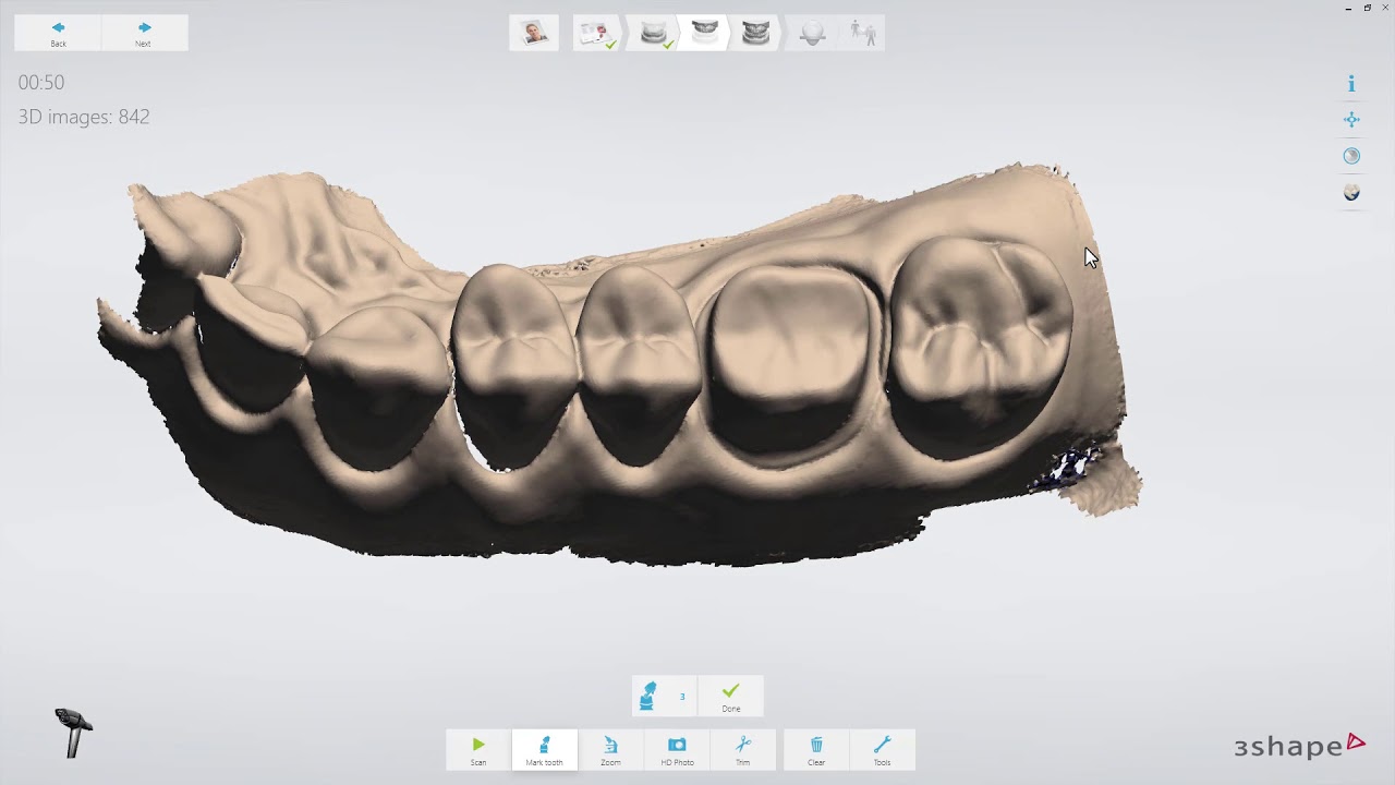 3Shape TRIOS - Crown Workflow IT