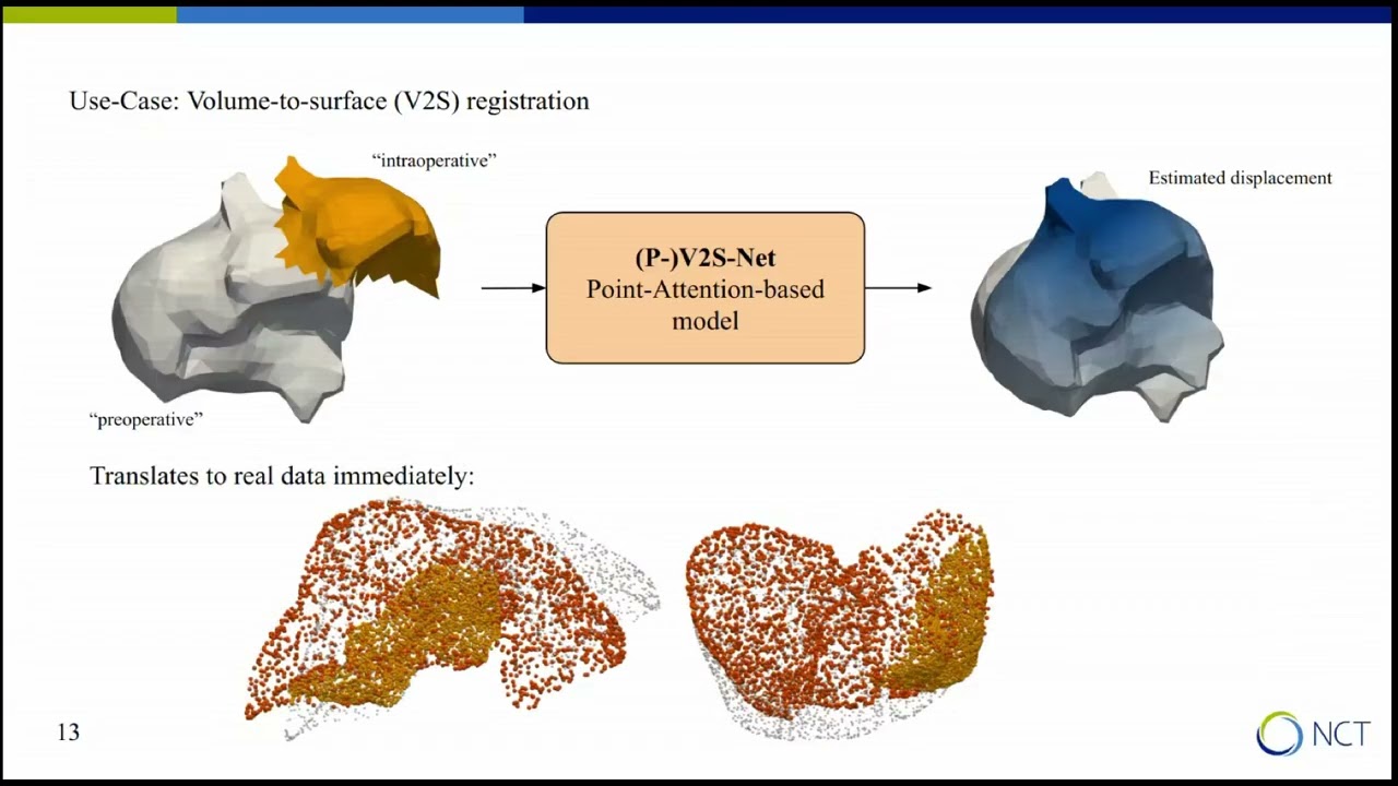 Software-Driven Computer Assisted Navigation in the Age of Deep Learning by Micha Pfeiffer