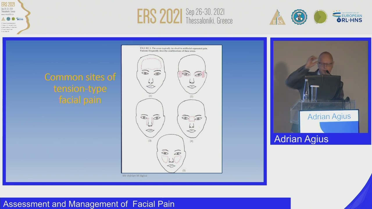 ERS Thessaloniki 2021, Assessment and Management of  Facial Pain, Adrian Agius