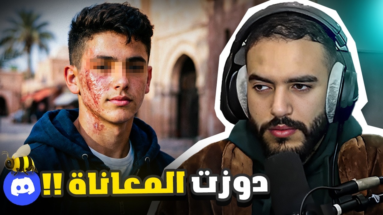 بسبب حرقة فوجهو عاش طفولة كحلة 💔 | Stronghive Stories
