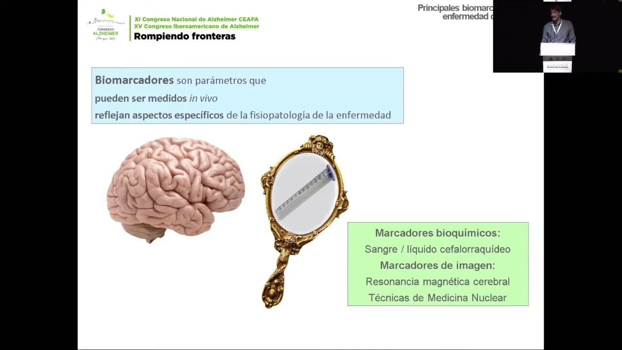 Biomarcadores en el diagn&oacute;stico precoz de la enfermedad de Alzheimer