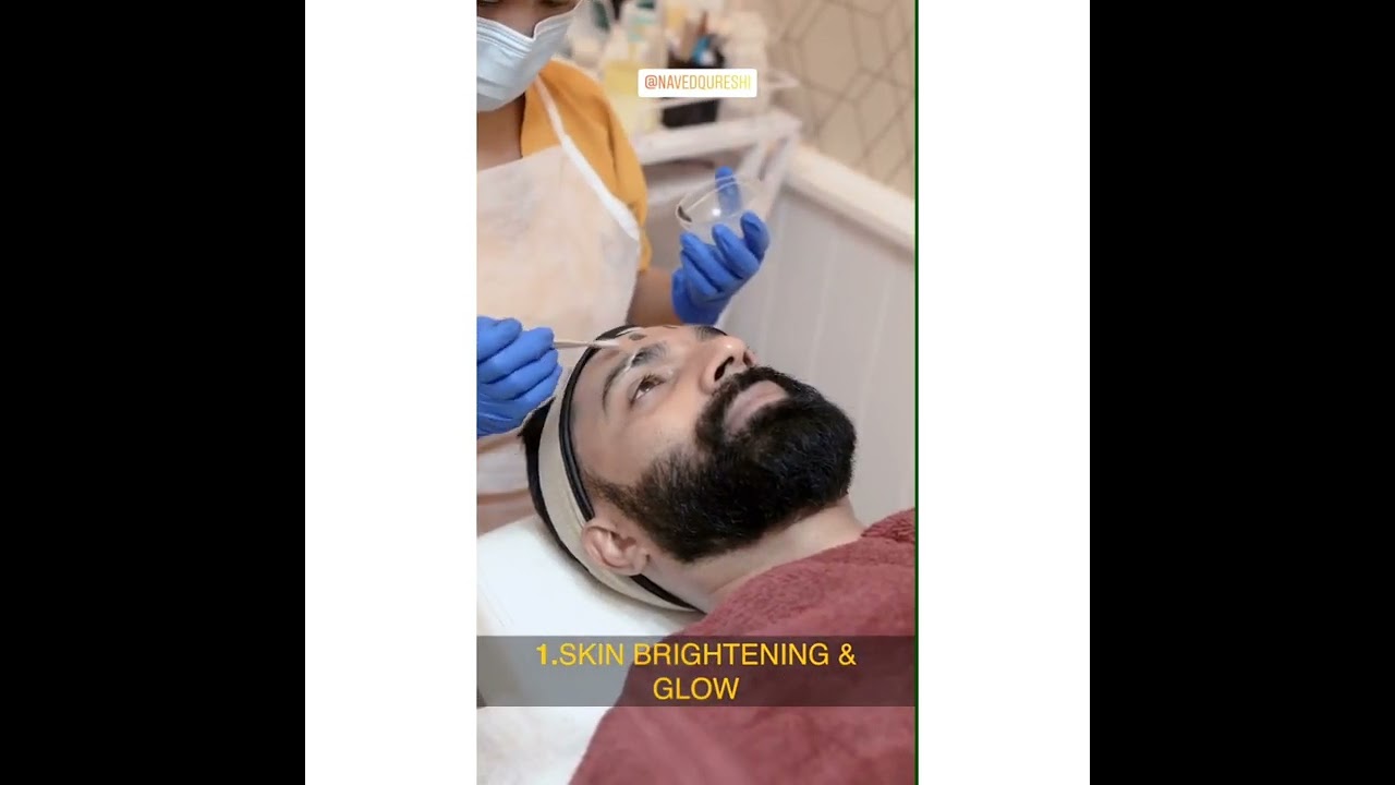 Carbon Peel Laser done at Dr Karishma Aesthetics for men #mensmonday #skincare #shorts