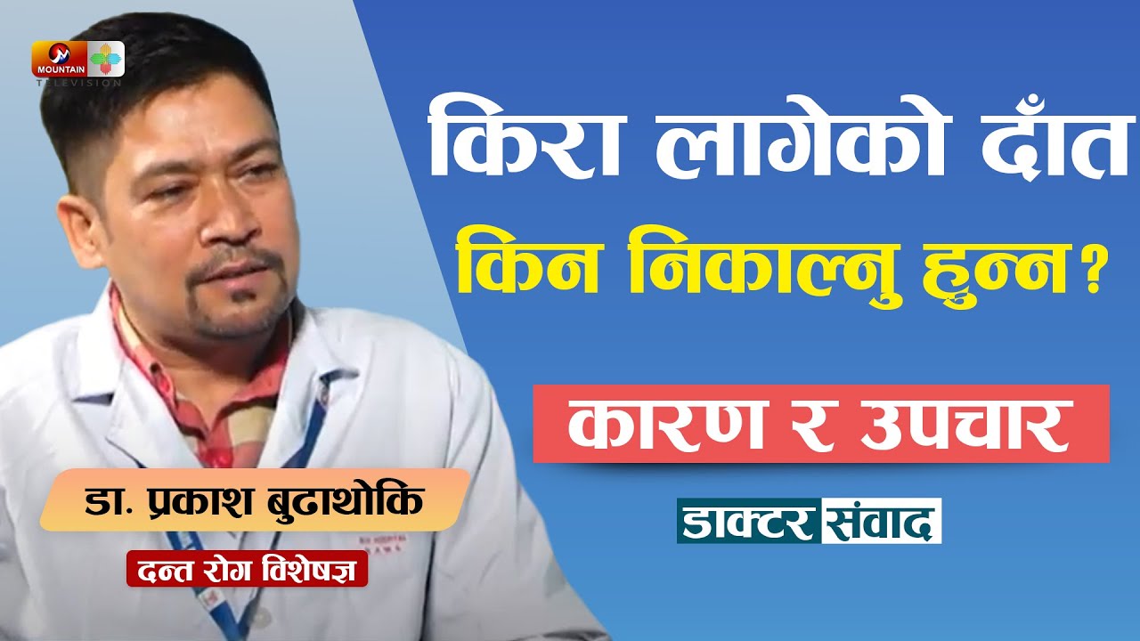 यस्ता कारणले गर्दा किरा लागेको दात दुखे पनि निकाल्नु हुन्न  ||  Health Desk