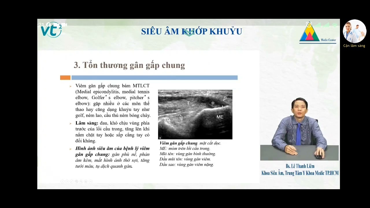SIÊU ÂM KHỚP KHUỶU | BS. Lê Thanh Liêm